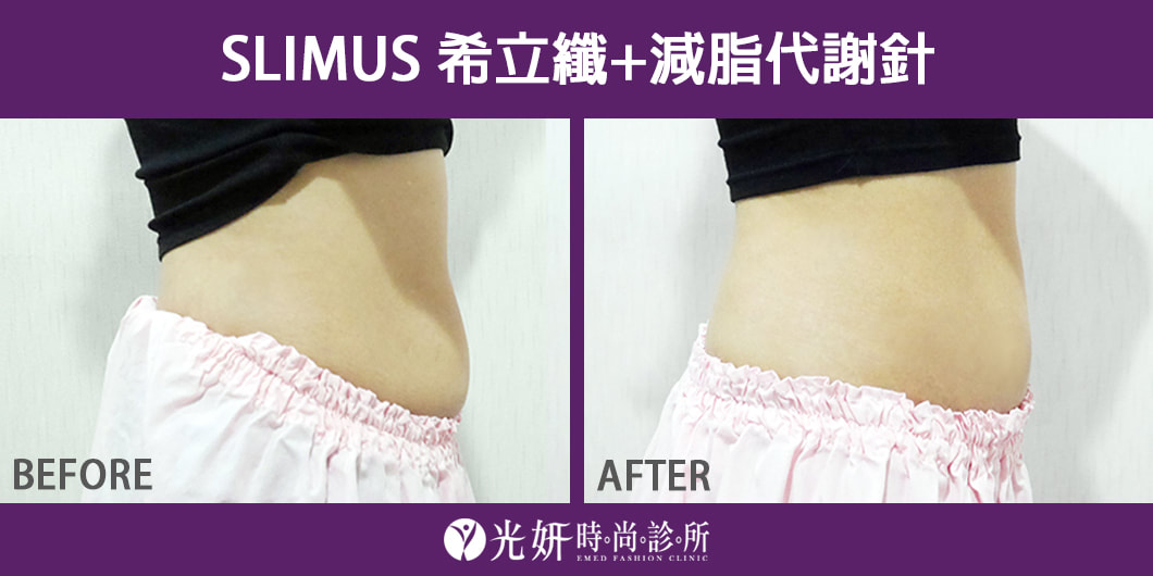SLIMUS希立纖+減脂代謝針