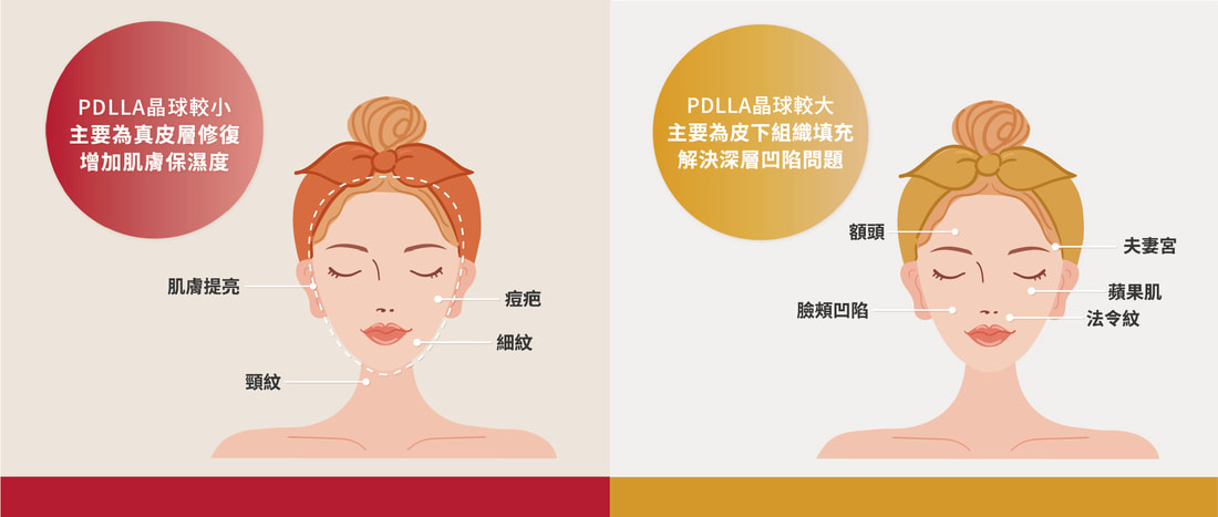 VIVABELLA 薇貝拉魔法針 圖片 4
