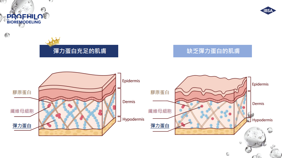 PROFHILO逆時針 圖片 10